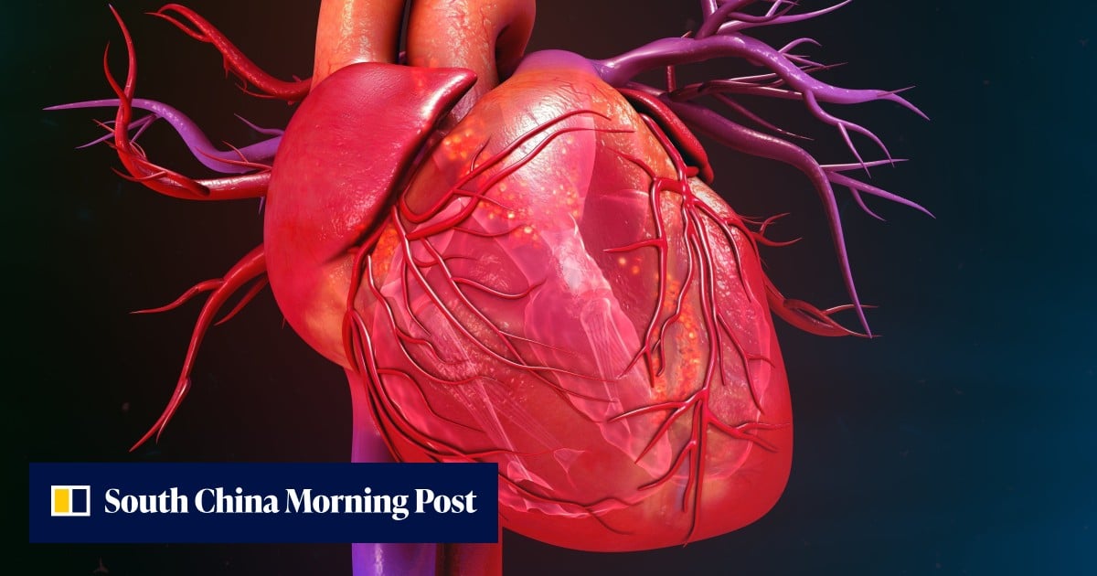 Nuevo tratamiento para cardiopatías